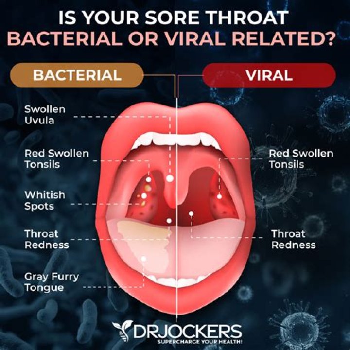 What causes sore throat but no fever?