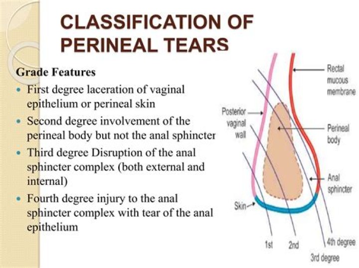 What causes the perineum to tear?