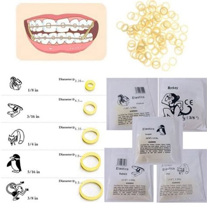 What cement is used for orthodontic bands?