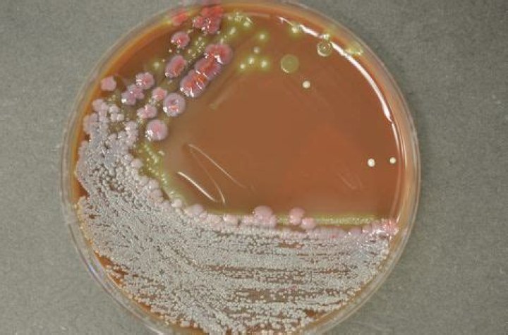 What color is Serratia marcescens?