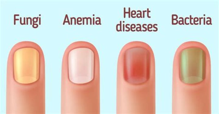 What color should be under your fingernails?