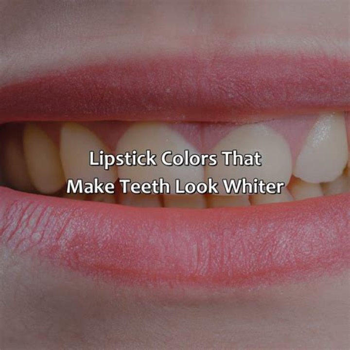 What colour lipstick makes teeth look white?