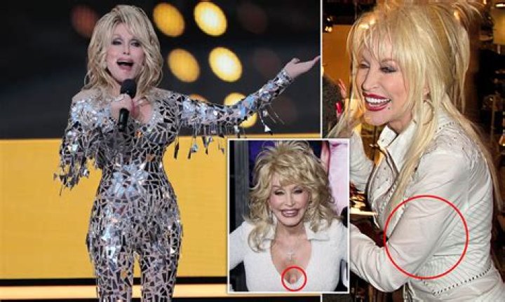What disorder does Dolly have in Ratched?