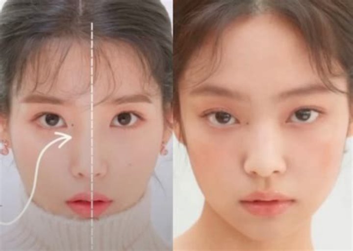 What do beauty moles mean?