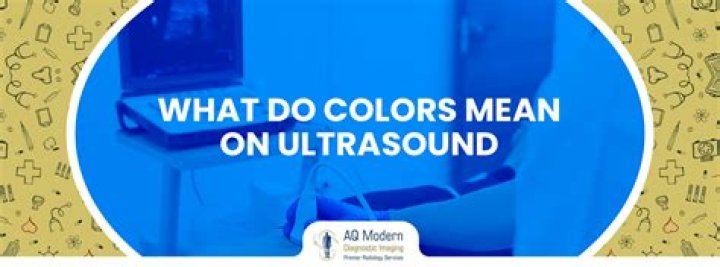 What do JUUL colors mean?