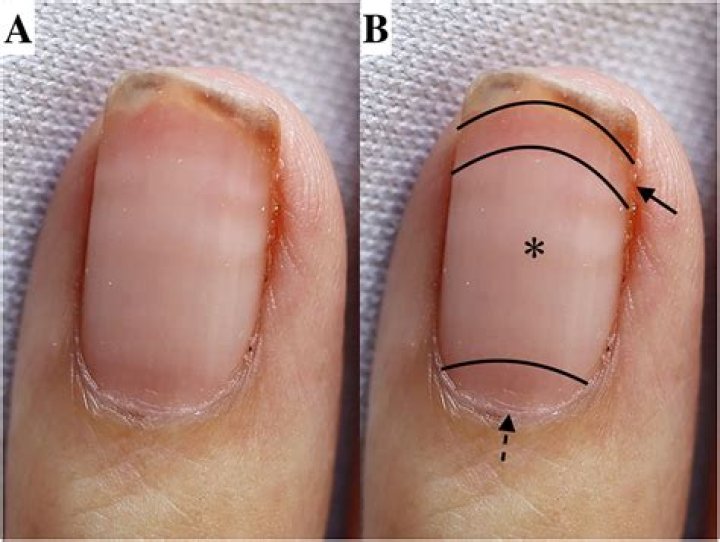 What do nails signify in the Bible?