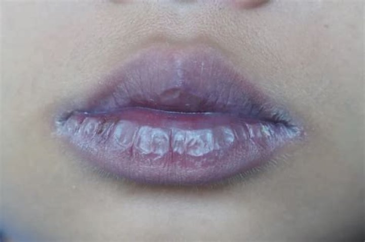 What do purple lips mean?