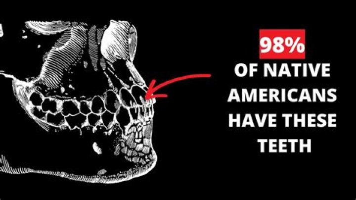 What do shovel-shaped teeth mean?
