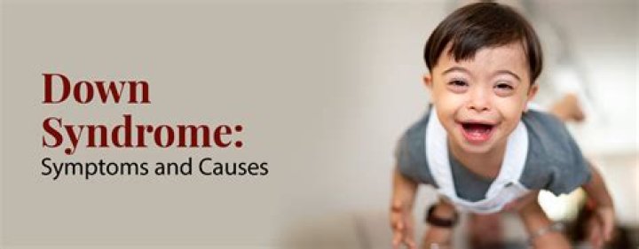 What do the 3 arrows for Down syndrome mean?