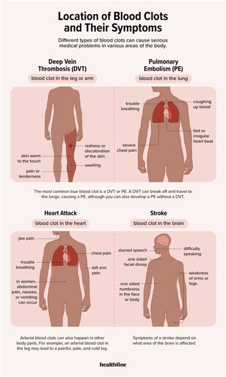 What does a blood clot headache feel like?