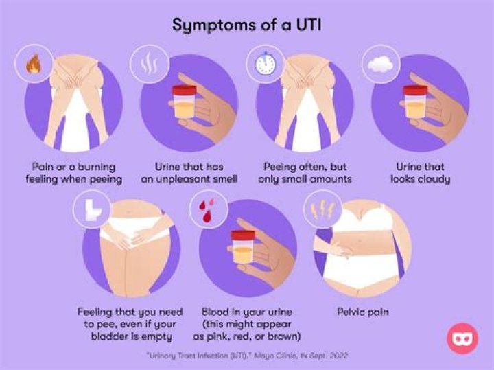 What does a UTI look like on a woman?