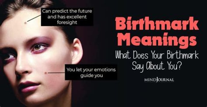 What does birthmark on nose mean?