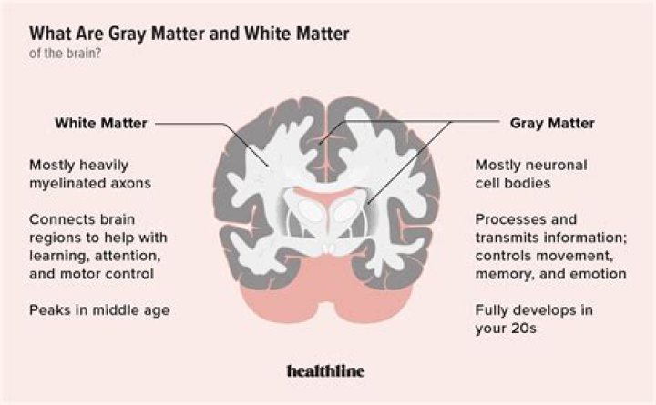 What does it mean if you have a lot of white matter in your brain?