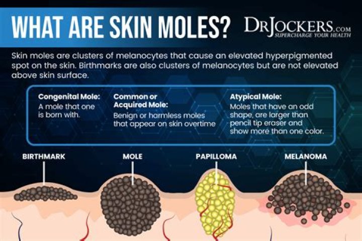 What does mole on shoulder mean?