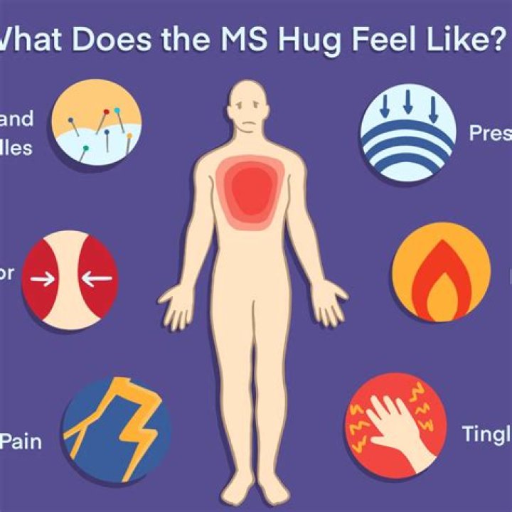 What does MS feel like in hands?