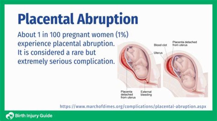 What does pain from placental abruption feel like?