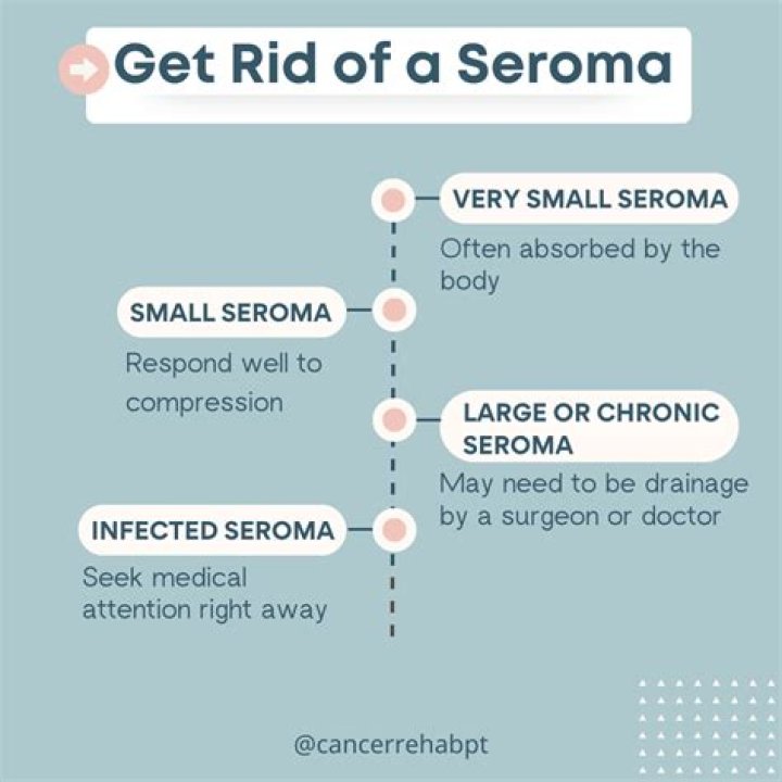 What does seroma fluid feel like?