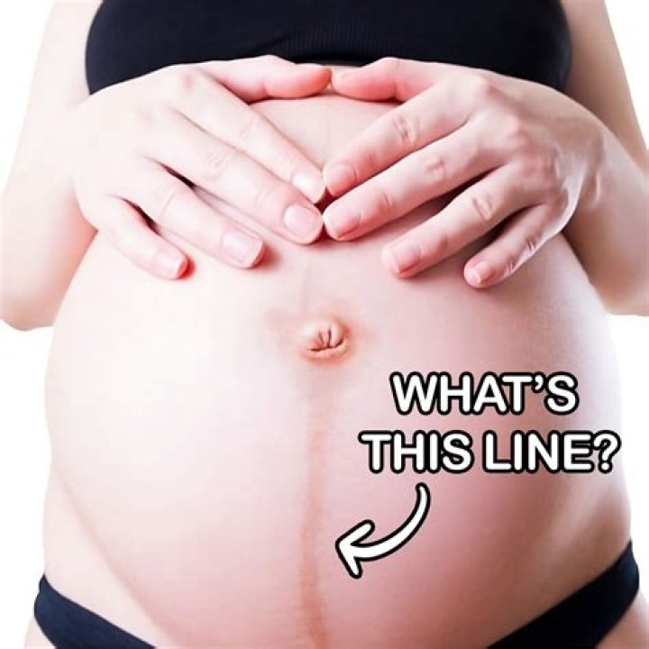 What does the black line on the tummy of a pregnant woman mean?