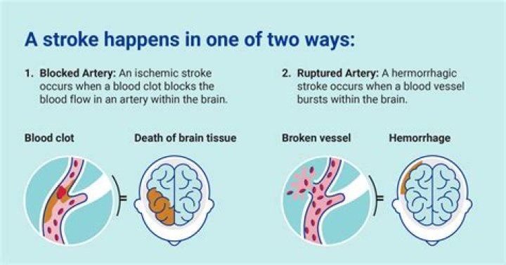 What does wet stroke mean?