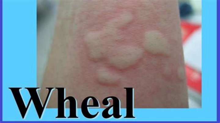 What does Wheal Leisure mean?