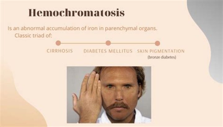 What does your skin look like with hemochromatosis?