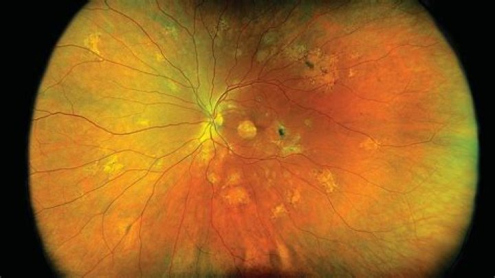 What happens during a retinal scan?