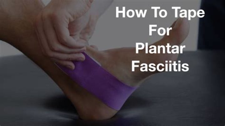What happens if a cortisone shot doesn't work for plantar fasciitis?