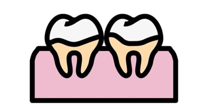 What happens if tartar is not removed?