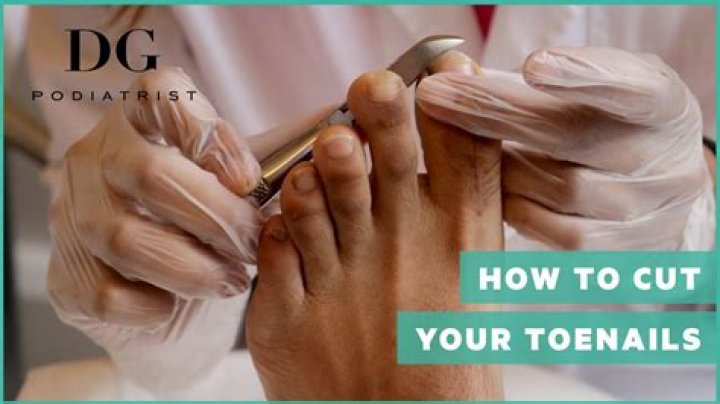What happens if you don't cut toenails?