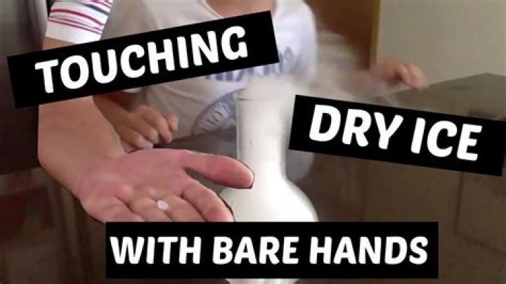 What happens if you touch dry ice with your bare hands?