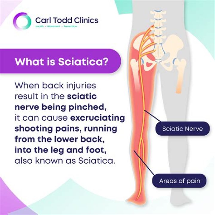 What happens when sciatica is left untreated?