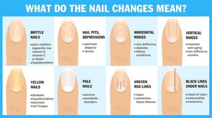 What happens when we rub our nails with each other?