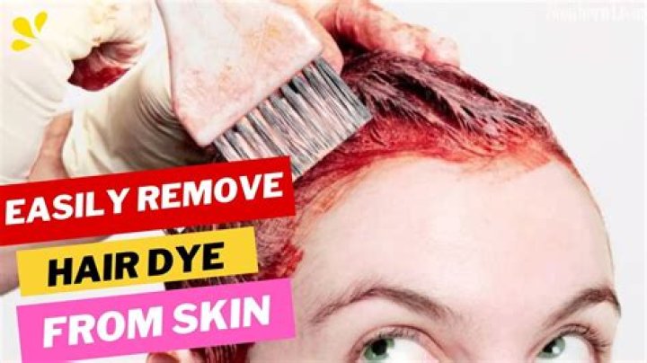 What home remedy can you use to get hair dye off your skin?