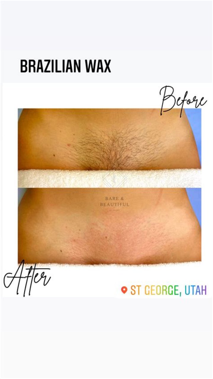 What is a Brazilian wax vs Hollywood wax?