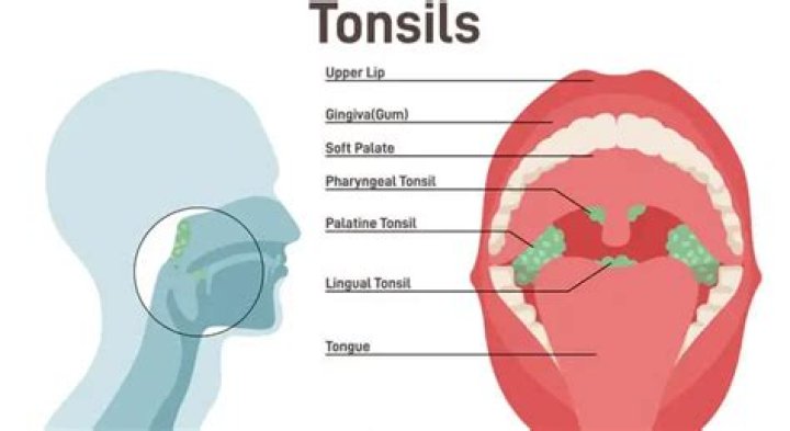 What is a good age to get your tonsils removed?