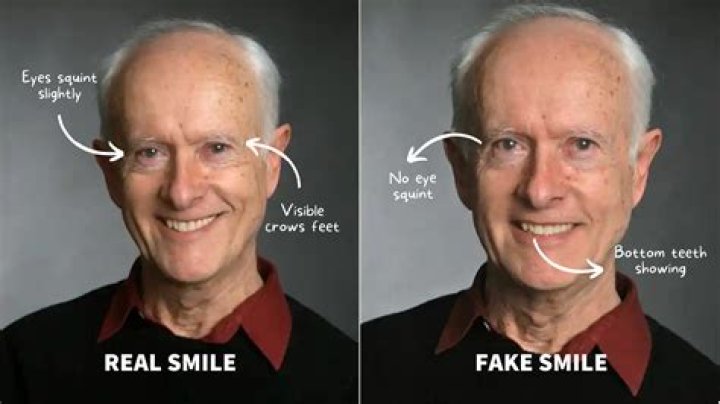 What is a natural smile?