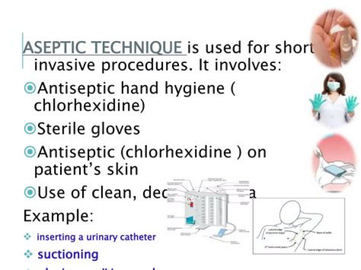 What is aseptic technique and why is it necessary quizlet?