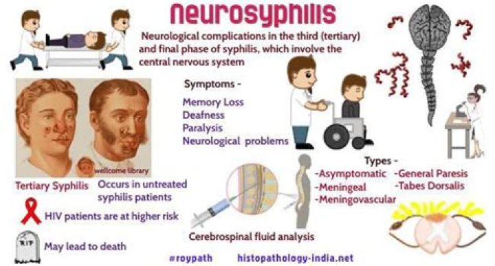 What is neuro syphilis?