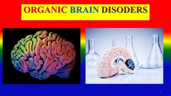 What is organic brain disorder?