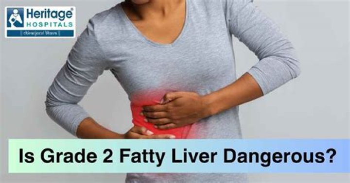 What is Stage 2 fatty liver?