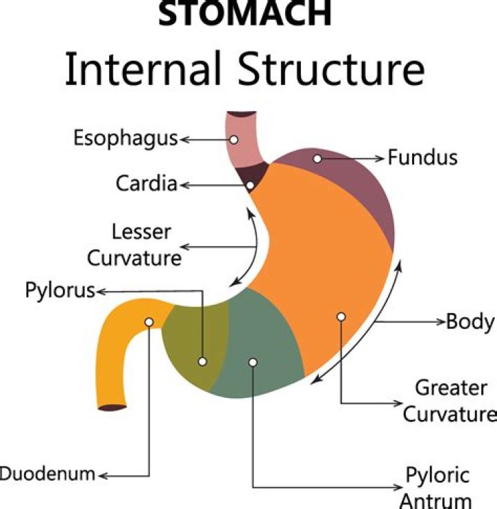 What is stomach phytobezoar?