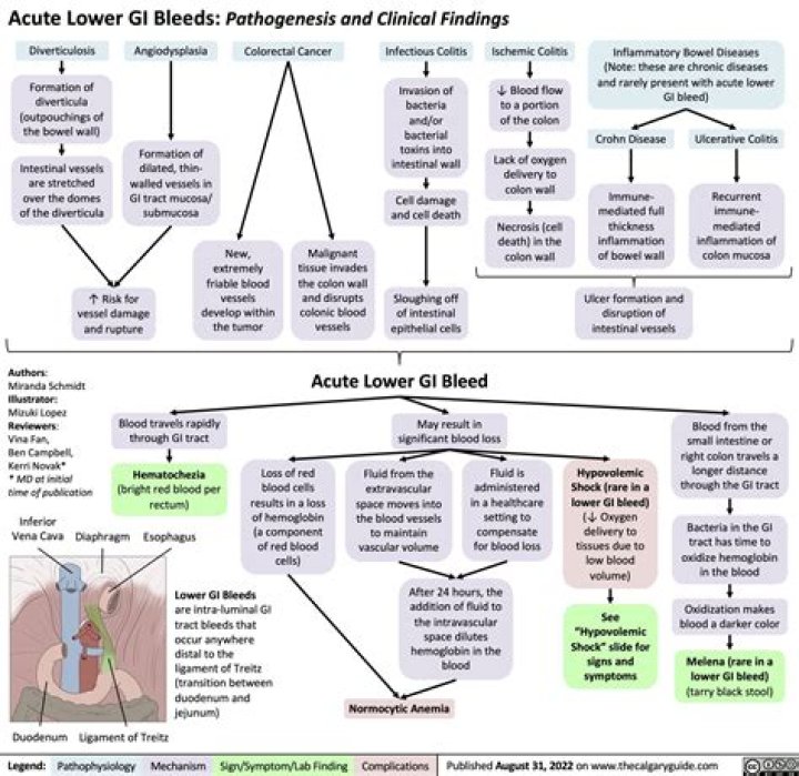 What is the most common cause of gastrointestinal hemorrhage?