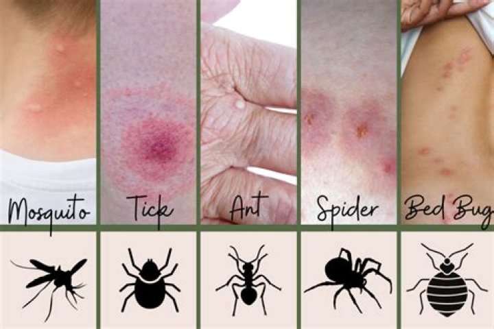 What kind of bugs are on monkeys?