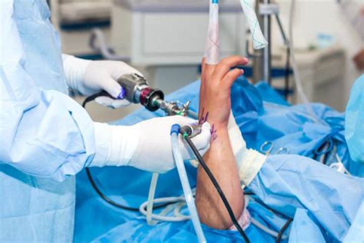 What kind of surgery is done for melanoma?
