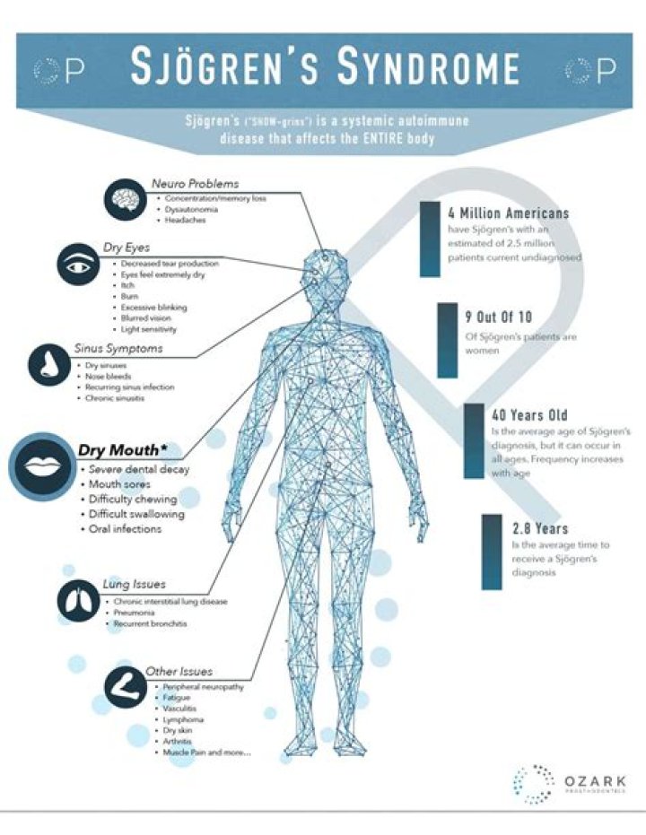 What mimics Sjogren's syndrome?