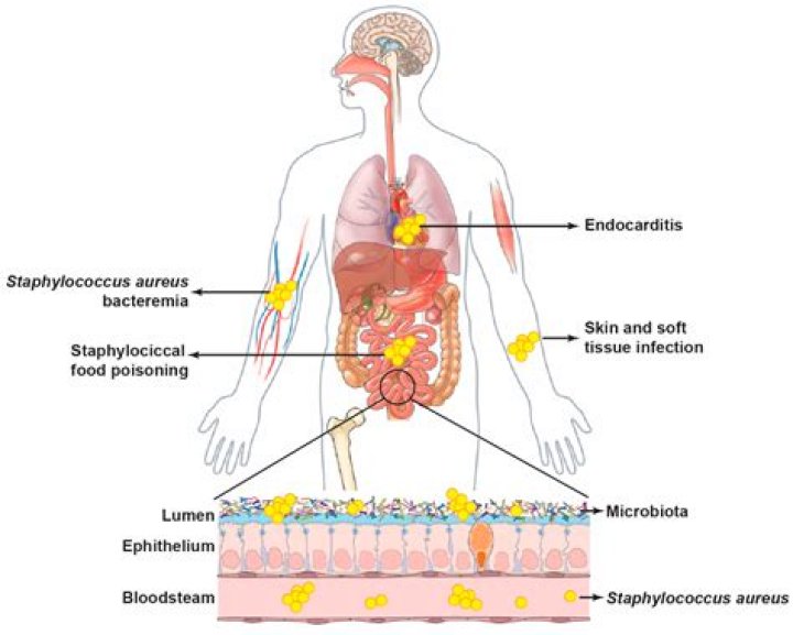 What part of the human body does Staphylococcus colonize?