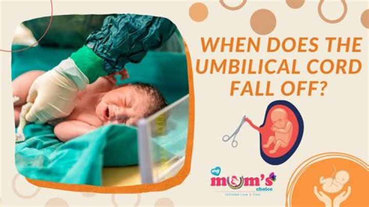 What should it look like when umbilical cord falls off?