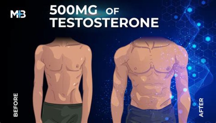 What testosterone is best?