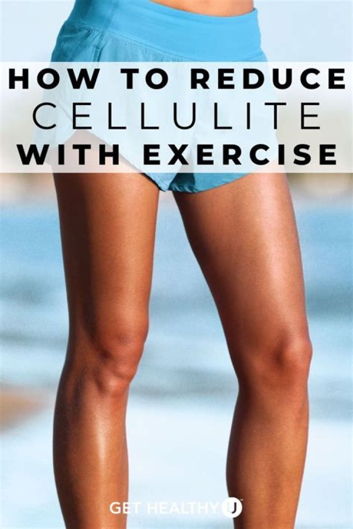 What truly gets rid of cellulite?