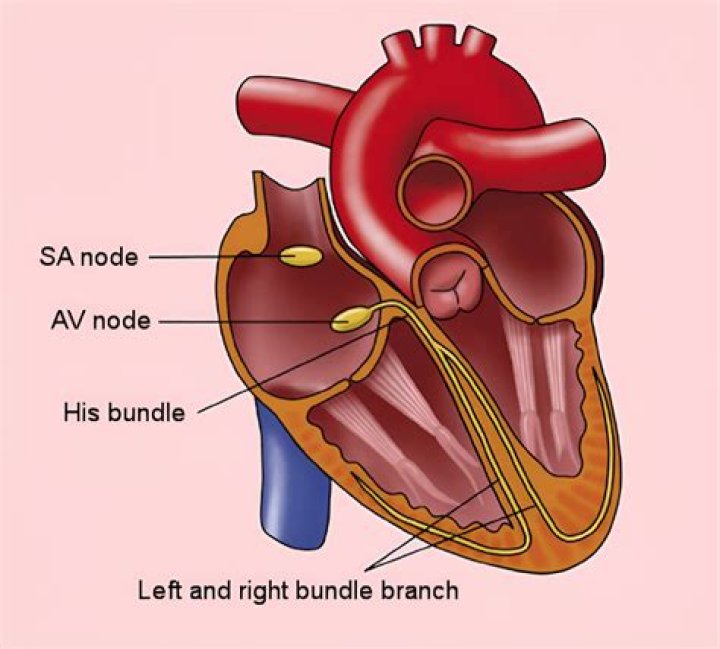 What's the difference between a node and a nodule?